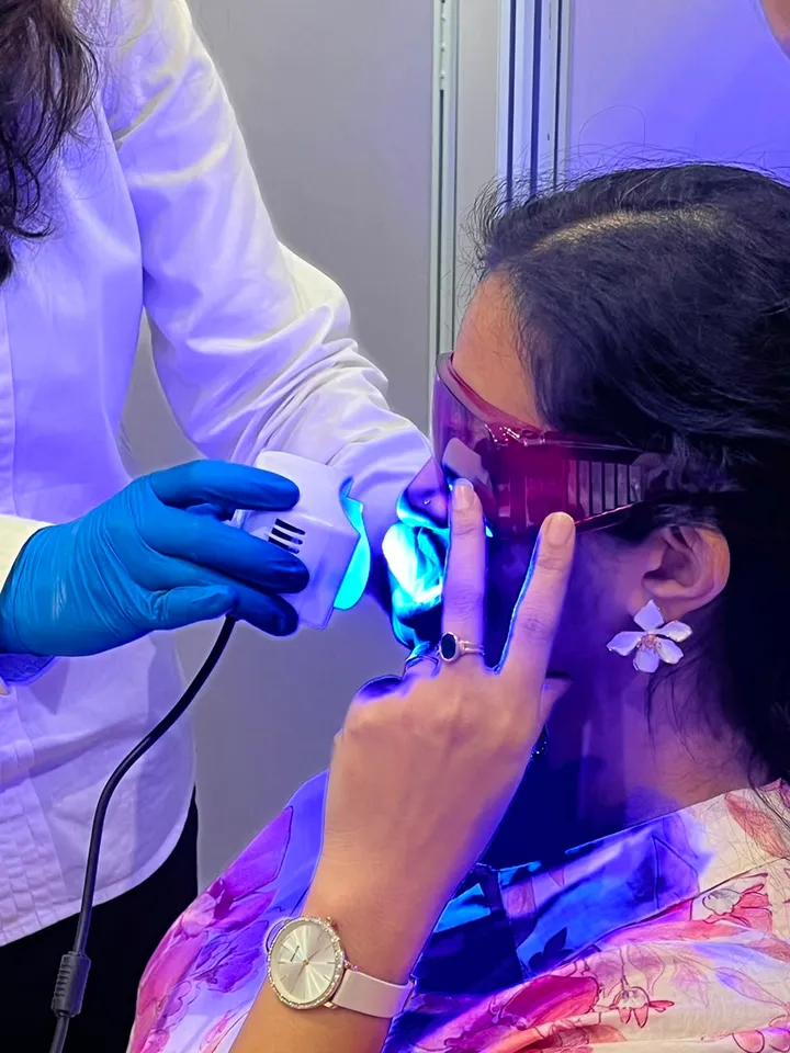 Teeth whitening, before and after